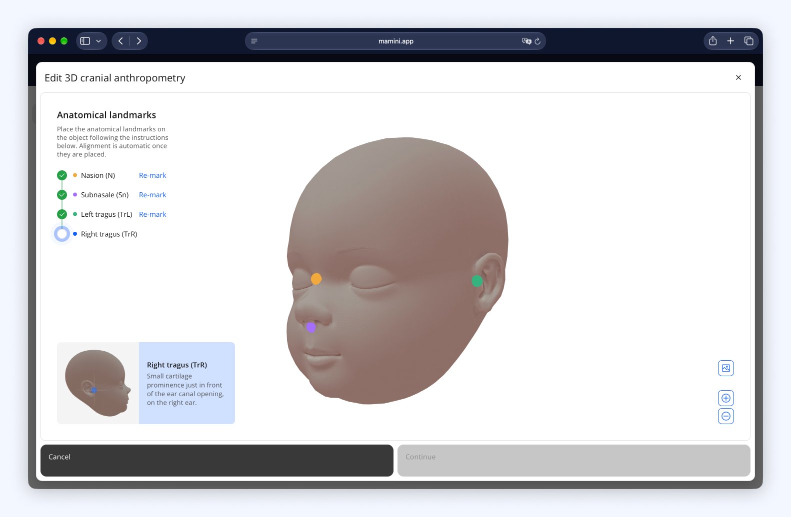Scanned head with the nasion, subnasale and both tragi marked in different colors, next to the list of the four anatomical landmarks.